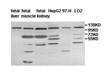 IMPG1 Rabbit Polyclonal Antibody