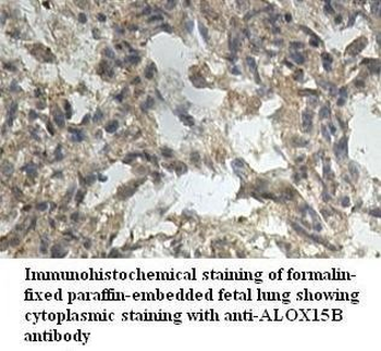 ALOX15B Rabbit Polyclonal Antibody