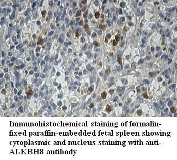 ALKBH8 Rabbit Polyclonal Antibody