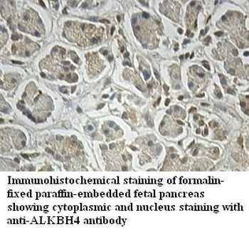 ALKBH4 Rabbit Polyclonal Antibody
