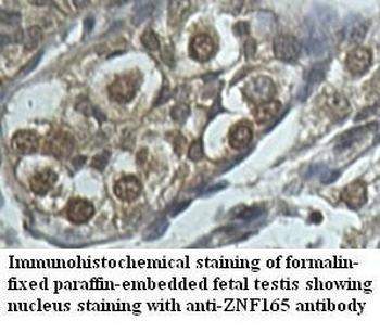 ZNF165 Rabbit Polyclonal Antibody