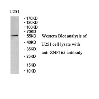 ZNF165 Rabbit Polyclonal Antibody