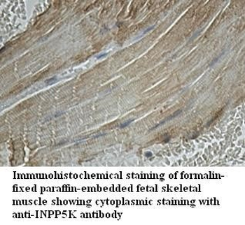 INPP5K Rabbit Polyclonal Antibody