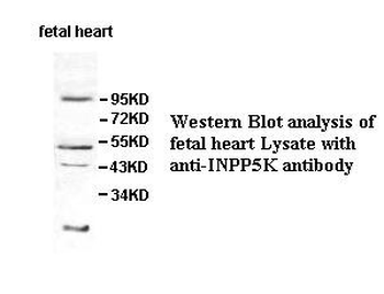 INPP5K Rabbit Polyclonal Antibody