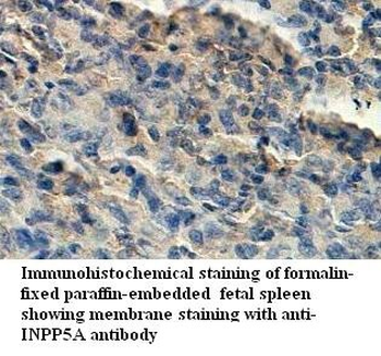 INPP5A Rabbit Polyclonal Antibody