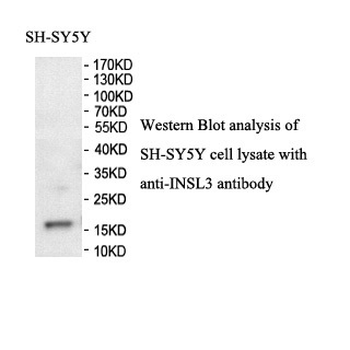 INSL3 Rabbit Polyclonal Antibody