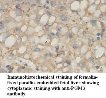 PGM3 Rabbit Polyclonal Antibody