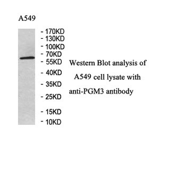 PGM3 Rabbit Polyclonal Antibody