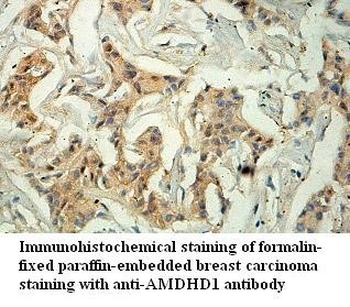 AMDHD1 Rabbit Polyclonal Antibody