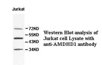 AMDHD1 Rabbit Polyclonal Antibody