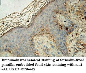 ALOXE3 Rabbit Polyclonal Antibody
