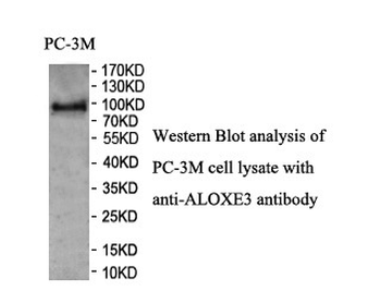 ALOXE3 Rabbit Polyclonal Antibody