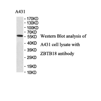 ZNF238 Rabbit Polyclonal Antibody