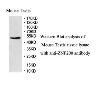 ZNF200 Rabbit Polyclonal Antibody