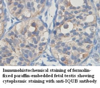 IQUB Rabbit Polyclonal Antibody