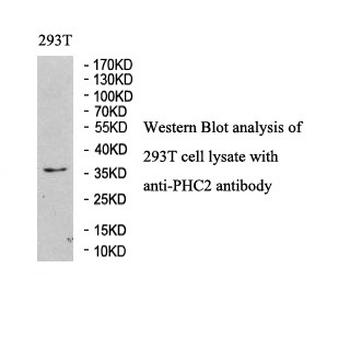 PHC2 Rabbit Polyclonal Antibody