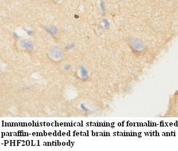 PHF20L1 Rabbit Polyclonal Antibody