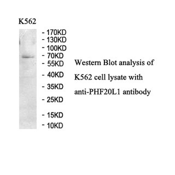 PHF20L1 Rabbit Polyclonal Antibody