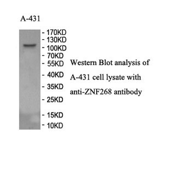ZNF268 Rabbit Polyclonal Antibody