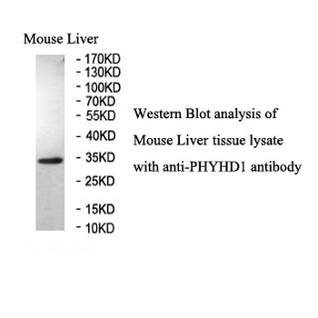 PHYHD1 Rabbit Polyclonal Antibody