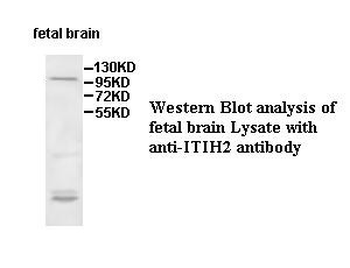 ITIH2 Rabbit Polyclonal Antibody