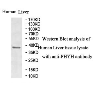 PHYH Rabbit Polyclonal Antibody