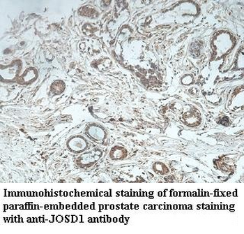 JOSD1 Rabbit Polyclonal Antibody