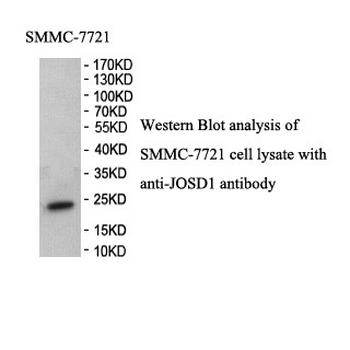 JOSD1 Rabbit Polyclonal Antibody