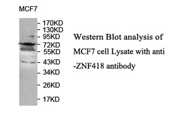 ZNF418 Rabbit Polyclonal Antibody