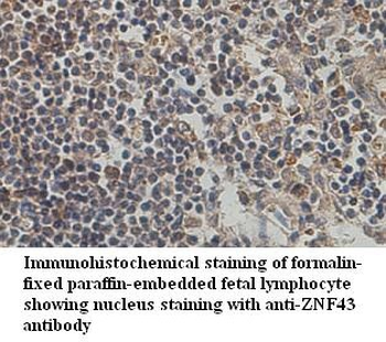ZNF43 Rabbit Polyclonal Antibody