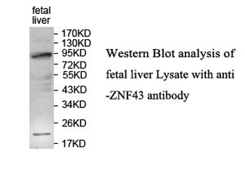 ZNF43 Rabbit Polyclonal Antibody
