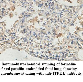 ITPKB Rabbit Polyclonal Antibody