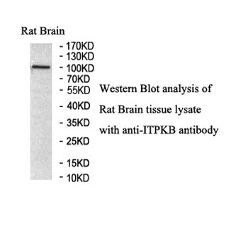 ITPKB Rabbit Polyclonal Antibody