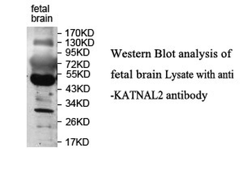 KATNAL2 Rabbit Polyclonal Antibody