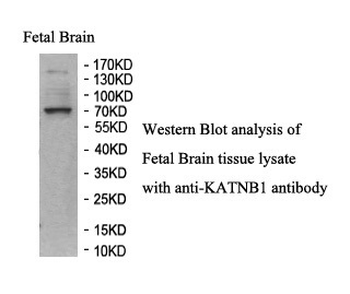 KATNB1 Rabbit Polyclonal Antibody