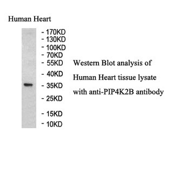 PIP4K2B Rabbit Polyclonal Antibody