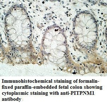 PITPNM1 Rabbit Polyclonal Antibody