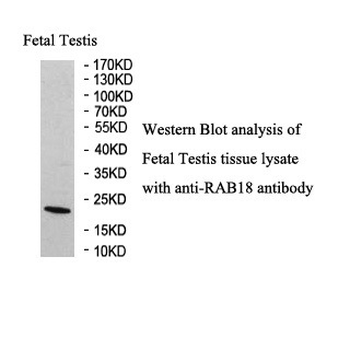 RAB18 Rabbit Polyclonal Antibody