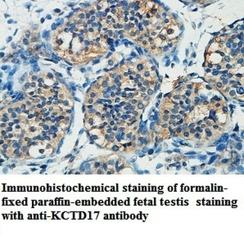 KCTD17 Rabbit Polyclonal Antibody