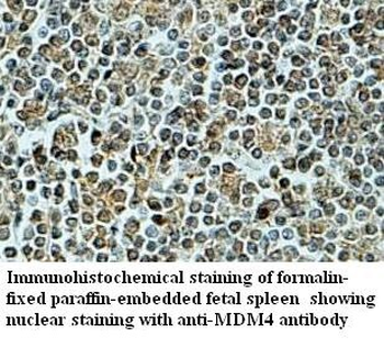 MDM4 Rabbit Polyclonal Antibody
