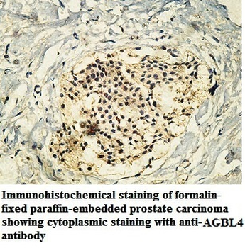 AGBL4 Rabbit Polyclonal Antibody