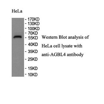 AGBL4 Rabbit Polyclonal Antibody