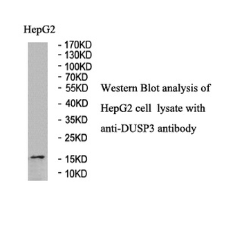 DUSP3 Rabbit Polyclonal Antibody