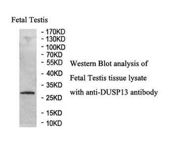 DUSP13 Rabbit Polyclonal Antibody