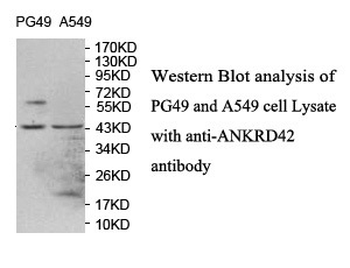 ANKRD42 Rabbit Polyclonal Antibody