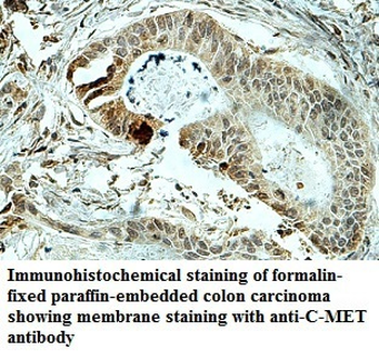 MET Rabbit Polyclonal Antibody