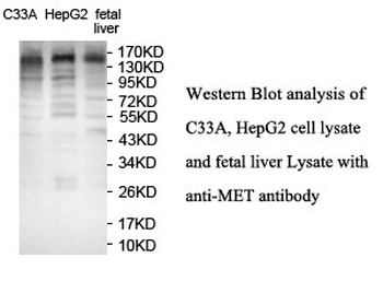 MET Rabbit Polyclonal Antibody