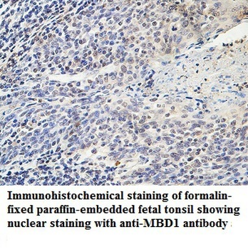 MBD1 Rabbit Polyclonal Antibody