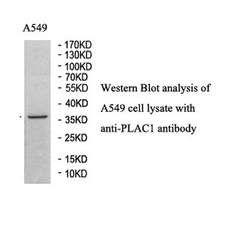 PLAC1 Rabbit Polyclonal Antibody