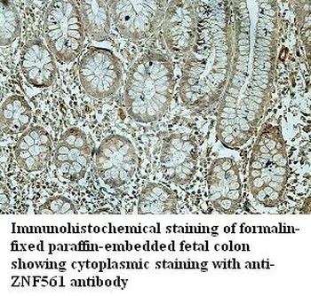 ZNF561 Rabbit Polyclonal Antibody